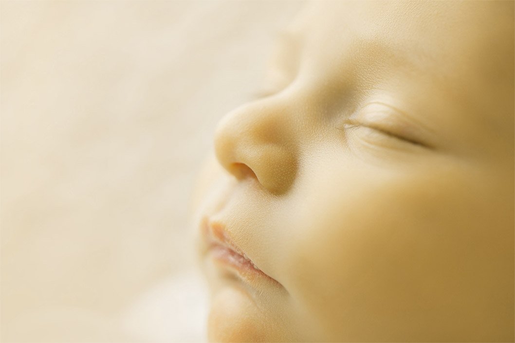 Color amarillo en la piel por la Ictericia neonatal