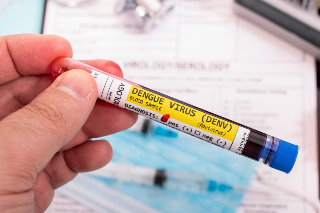 Diagnóstico de Dengue, ¿Qué examan de laboratorio me pueden pedir?